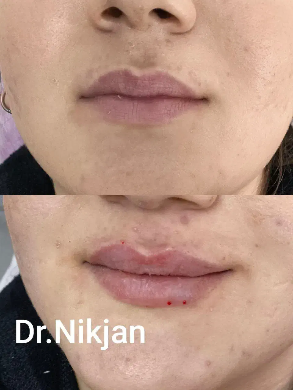 تخفیف ویژه افتتاحیه کلینیک زیبایی دکتر نیک جان|خدمات آرایشگری و زیبایی|رشت, گلسار|دیوار