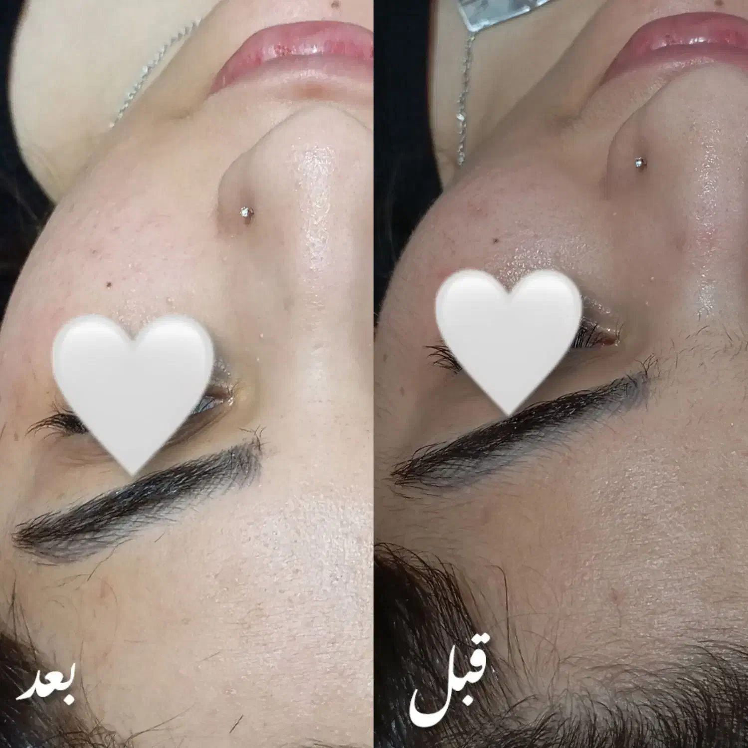 درما|خدمات آرایشگری و زیبایی|هامون, |دیوار