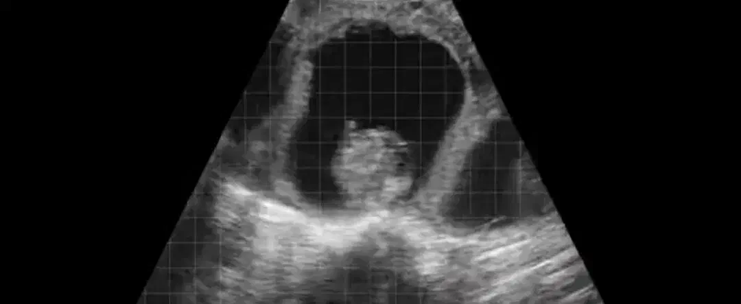 سونوگرافی انواع دام|حیوانات مزرعه|اصفهان, بوستان کوهستانی صفه|دیوار