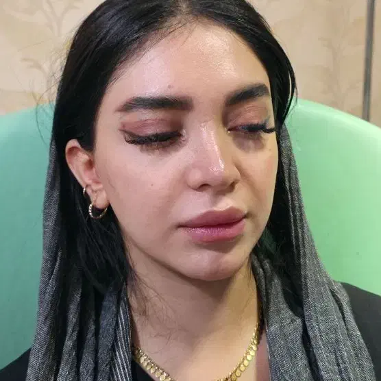 جشنواره کلینیک ژل و بوتاکس ۵۹۰|خدمات آرایشگری و زیبایی|اصفهان, خلجا|دیوار