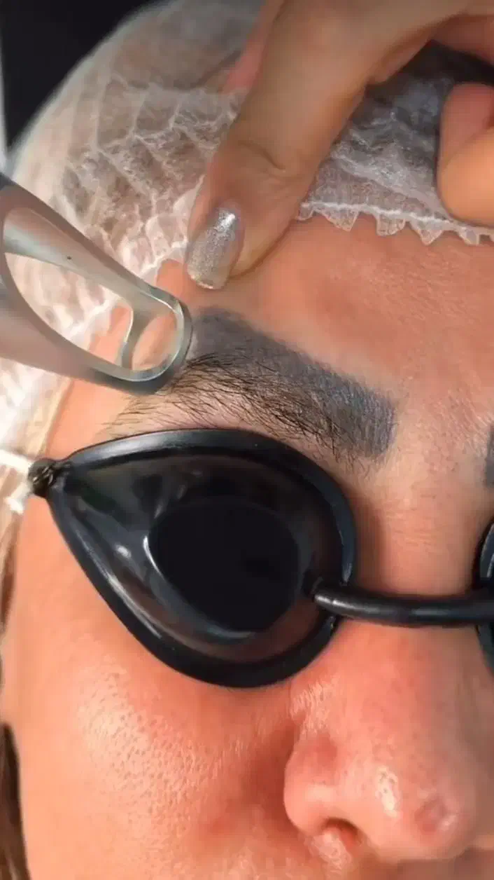 لیزر تتو های قدیمی تتوی صورت و بدن فقط ۵۰۰|خدمات آرایشگری و زیبایی|فولادشهر, C3|دیوار