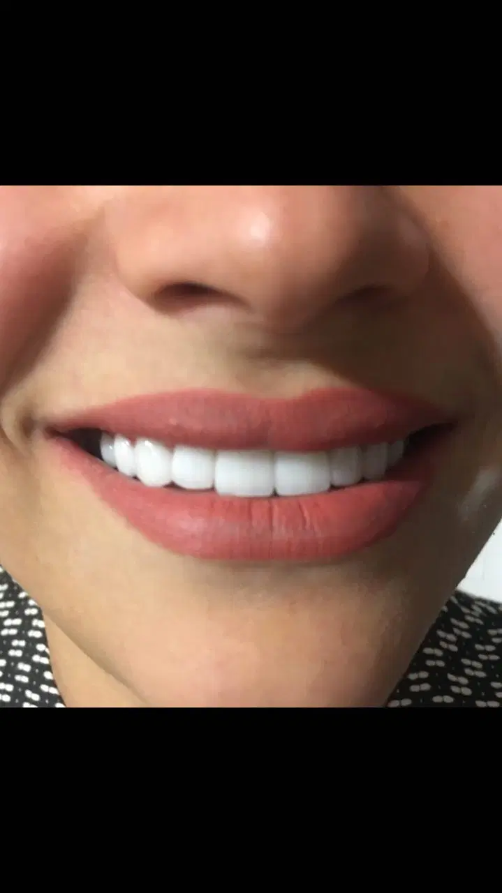 کارگاه ساخت دست دندان مصنوعی و لمینیت|خدمات زیبایی و سلامت|تهران, شهرک شریعتی|دیوار