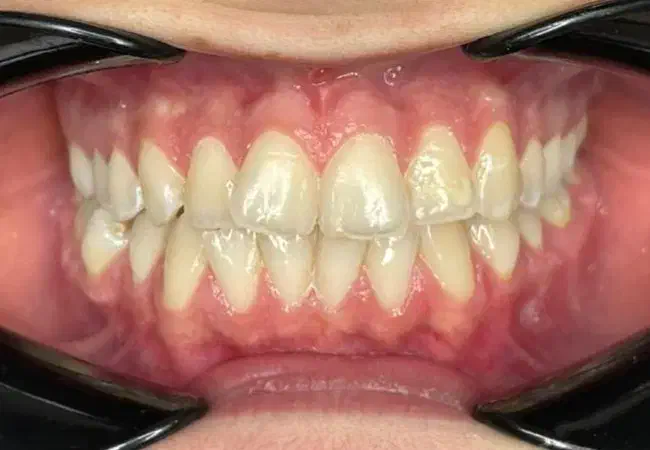 دستیار دندانپزشکی|استخدام درمانی، زیبایی، بهداشتی|رشت, بوسار|دیوار