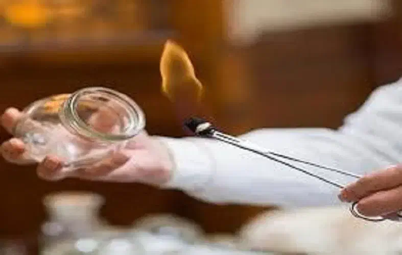 اموزش تخصصی حجامت ،زالو درمانی و بادکش|خدمات آموزشی|تهران, شهرک آزادی|دیوار