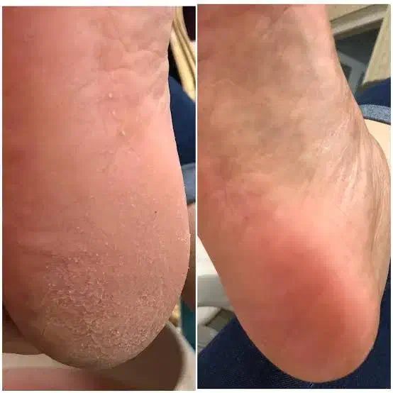 off کاشت ناخن دست و پا و کفسابی کف پا|خدمات آرایشگری و زیبایی|نجفآباد, هفده شهریور|دیوار