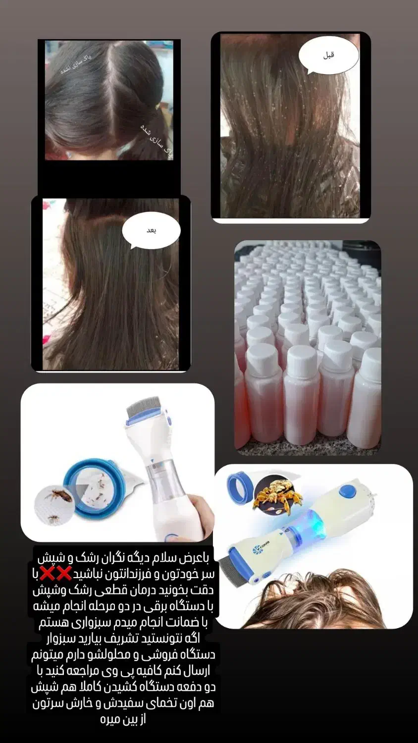 درمان قطعی رشک و شپش با ضمانت|آرایشی، بهداشتی، درمانی|سبزوار, امیر کبیر|دیوار