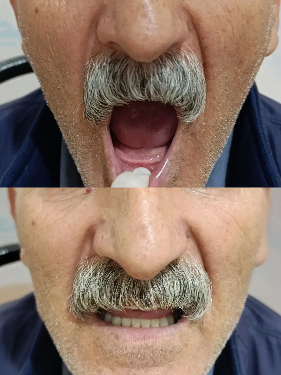 دندان مصنوعی|خدمات آرایشگری و زیبایی|آبیک, |دیوار