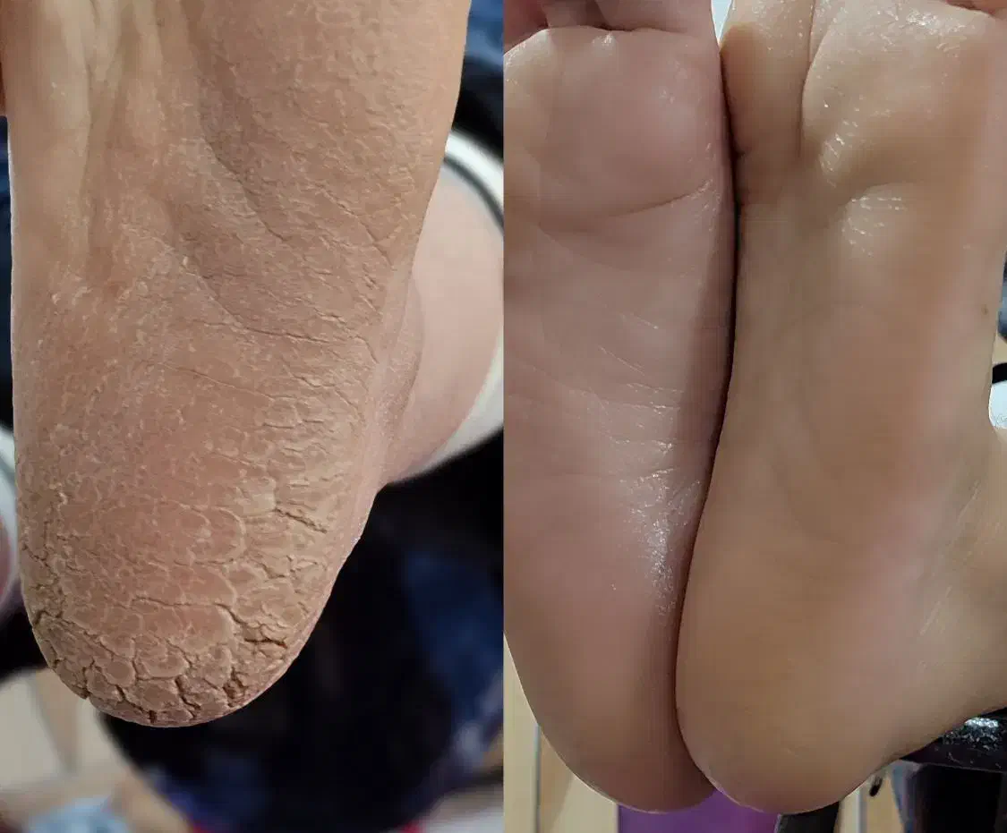 پدیکور|خدمات آرایشگری و زیبایی|تهران, تهرانپارس شرقی|دیوار