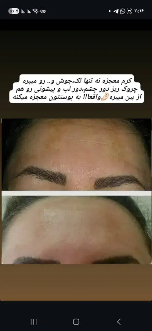 روغن درمانی  وروغن تراپی|آرایشی، بهداشتی، درمانی|مرند, |دیوار