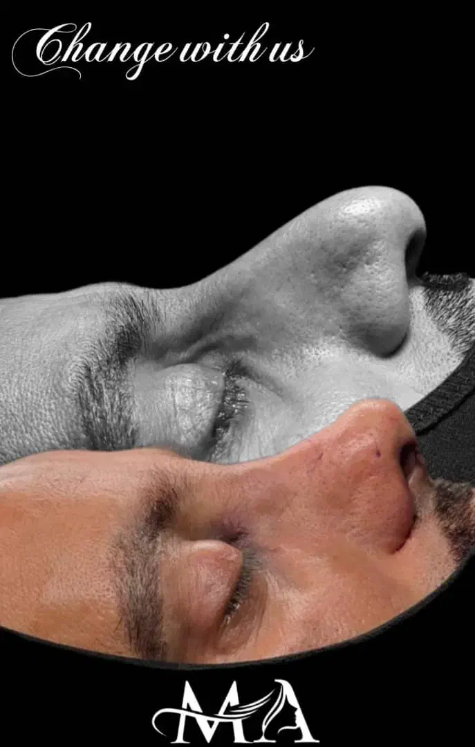 جشنواره جراحی و عمل بینی در کرج|خدمات آرایشگری و زیبایی|چهارباغ, |دیوار