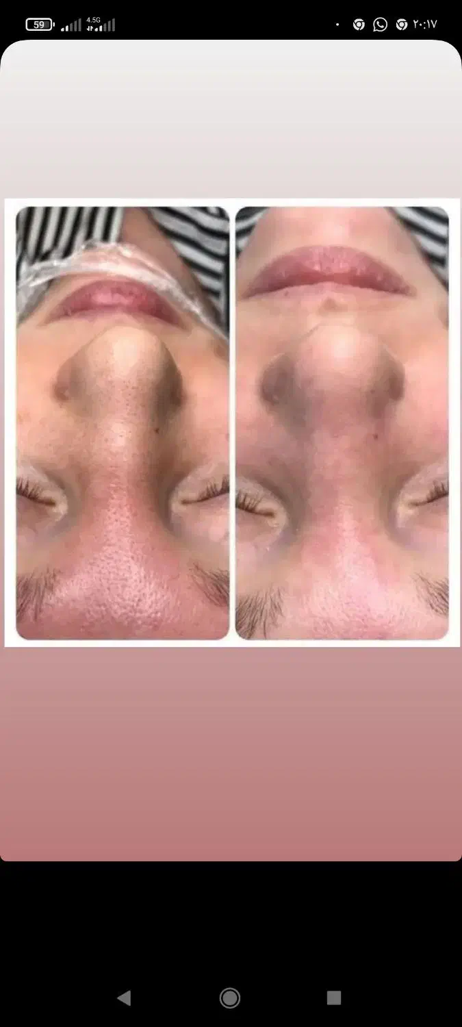 فشیال و پاکسازی سنتی|خدمات آرایشگری و زیبایی|سهند, |دیوار