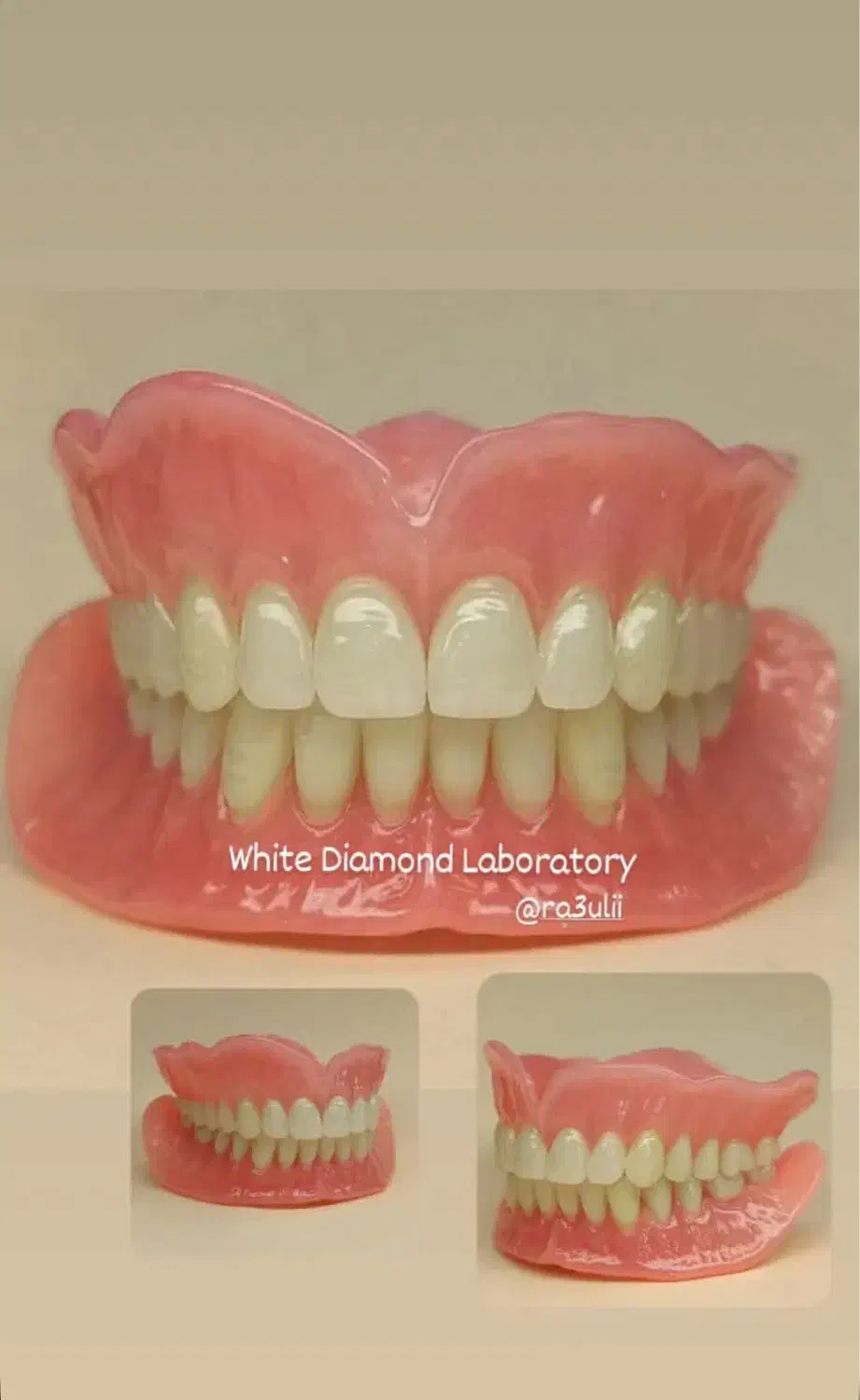 ساخت دندان مصنوعی|خدمات آرایشگری و زیبایی|اردبیل, |دیوار