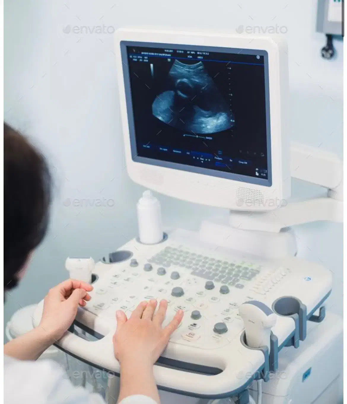 استخدام تایپیست در مطب سونوگرافی|استخدام درمانی، زیبایی، بهداشتی|کرمان, |دیوار