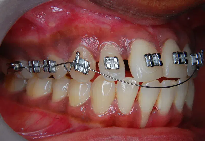 ارتودنسی رایگان کودکان ۶تا ۱۰ سال|خدمات آرایشگری و زیبایی|تهران, خاک سفید|دیوار