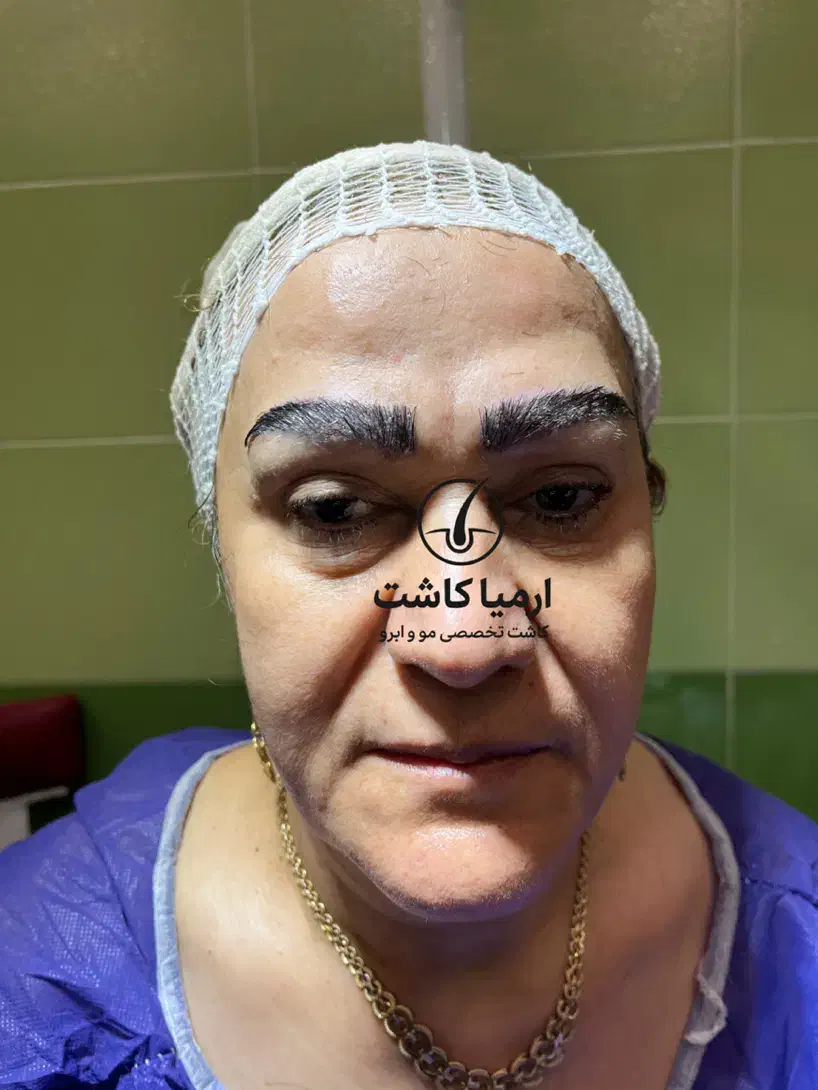 مدل کاشت ابرو|خدمات آرایشگری و زیبایی|گرگان, |دیوار