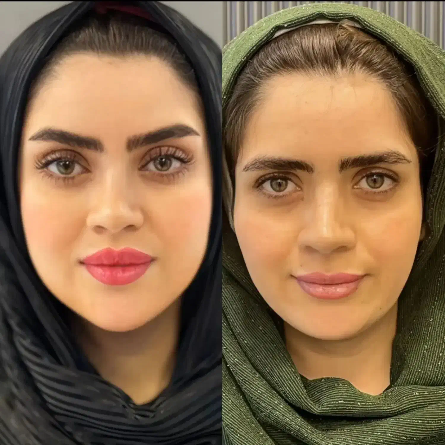 تخفیف به مناسبت روز مادر /ژل لب- کانتورینگ- بوتاکس|خدمات آرایشگری و زیبایی|مشهد, ایثار|دیوار