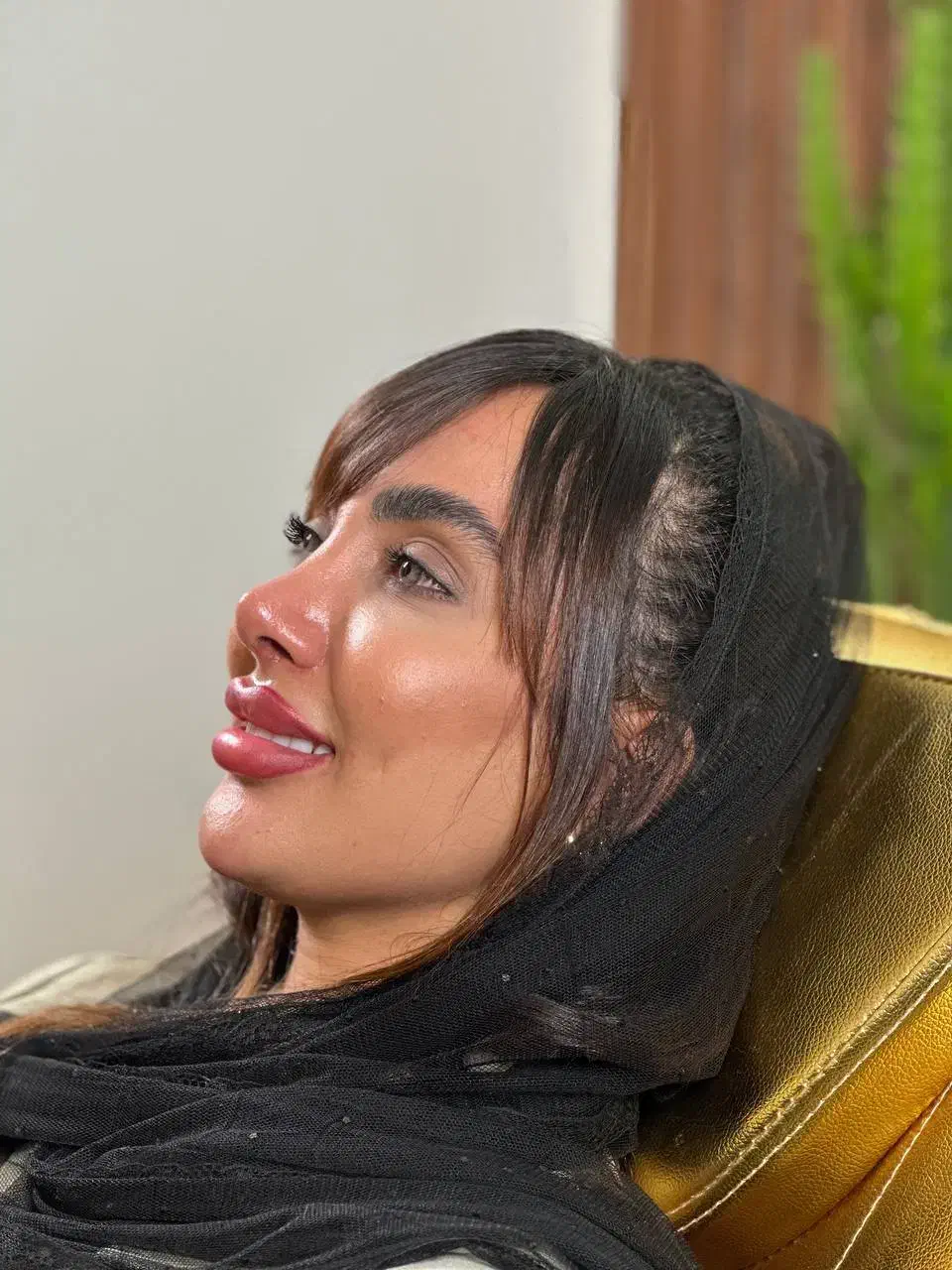 عمل بینی لیفت صورت اقساط تا۲۴ ماه|خدمات آرایشگری و زیبایی|تهران, تجریش|دیوار