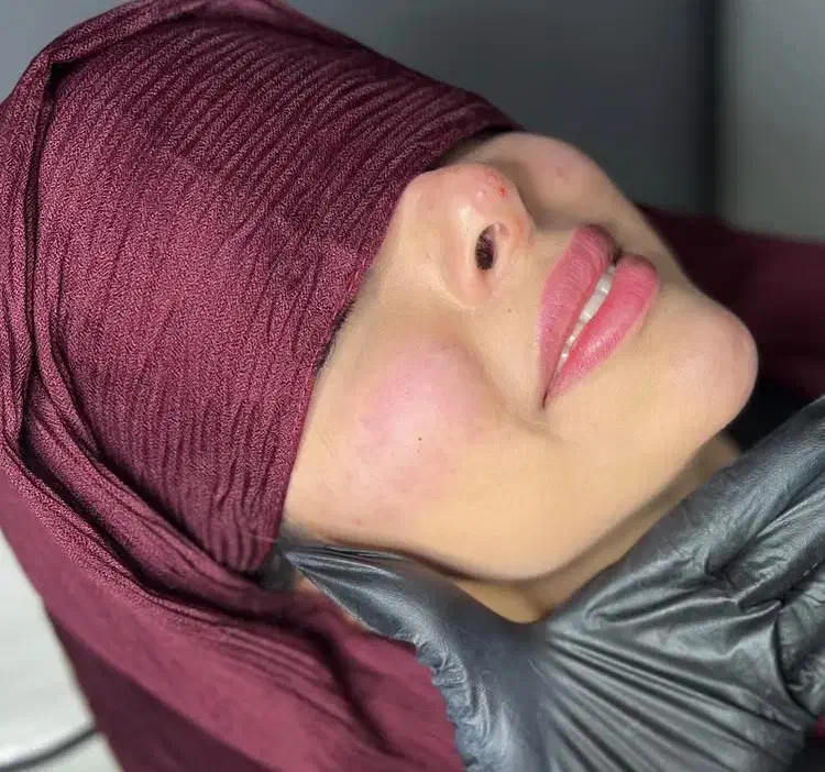 تزریق فیلر و بوتاکس و آنزیم با بهترین کیفیت|خدمات آرایشگری و زیبایی|قم, صدوق|دیوار