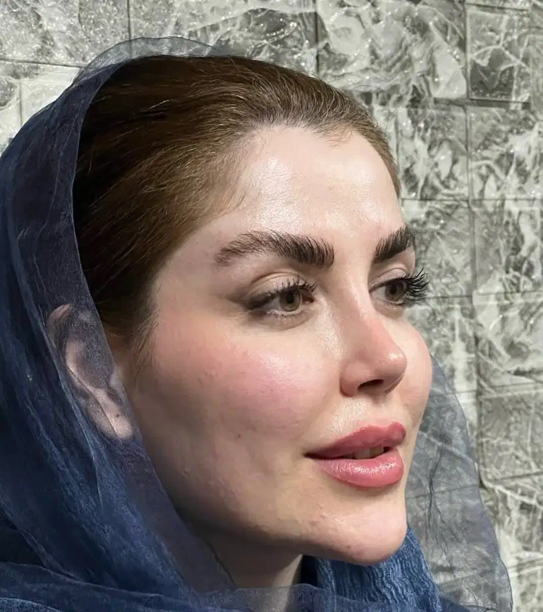 عمل جراحی بینی توسط متخصص زیباییent/ترمیم بینی|خدمات آرایشگری و زیبایی|کرج, چهارصد دستگاه|دیوار