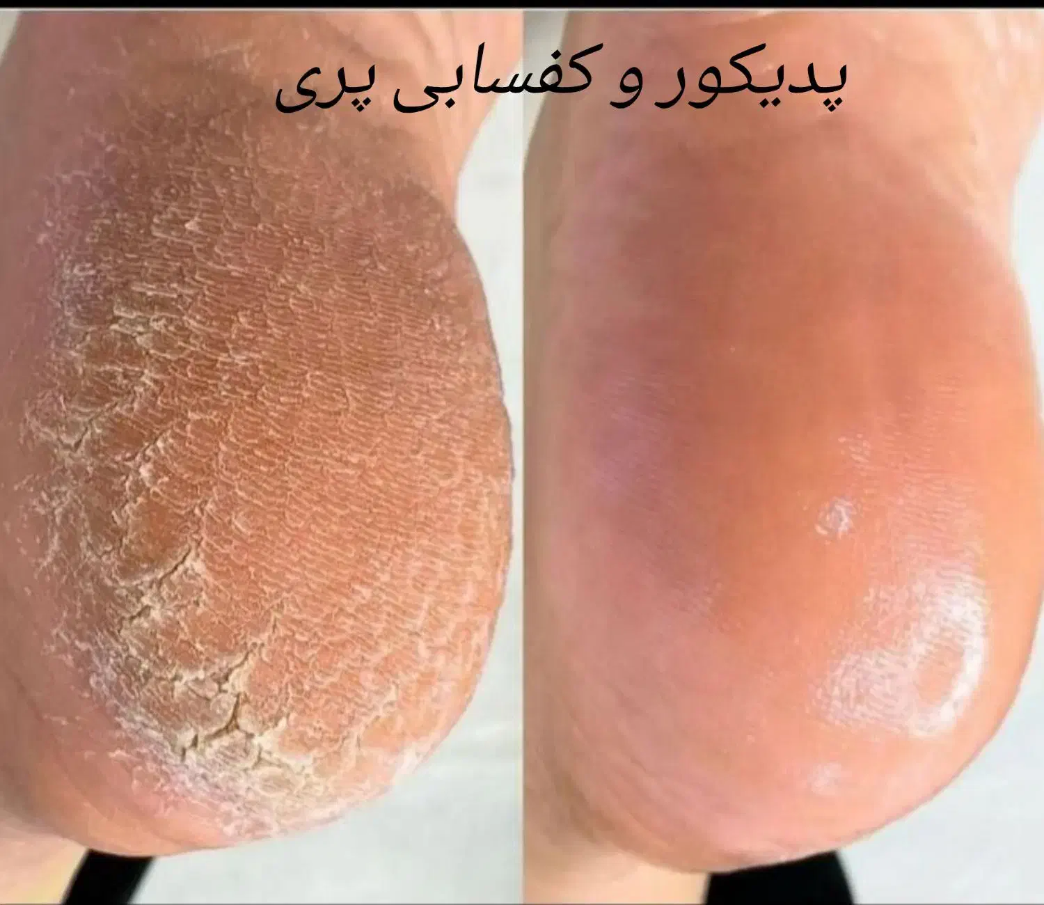 اولین کلینیک تخصصی پدیکور پا|خدمات آرایشگری و زیبایی|کرمانشاه, |دیوار