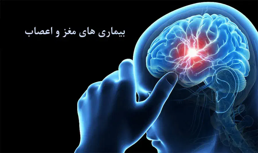 میگرن و مشکلات اعصاب|آرایشی، بهداشتی، درمانی|مهاباد (آذربایجان غربی), |دیوار