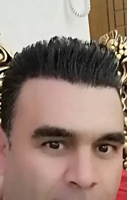 کاشت مو ابرو به بروز ترین با شرایط پرداخت اقساطی|خدمات آرایشگری و زیبایی|تبریز, |دیوار