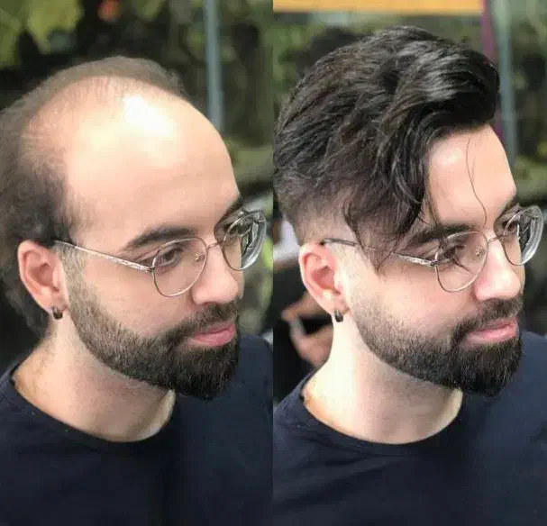 خدا حافظی با بی مویی|خدمات آرایشگری و زیبایی|فردیس, فردیس|دیوار