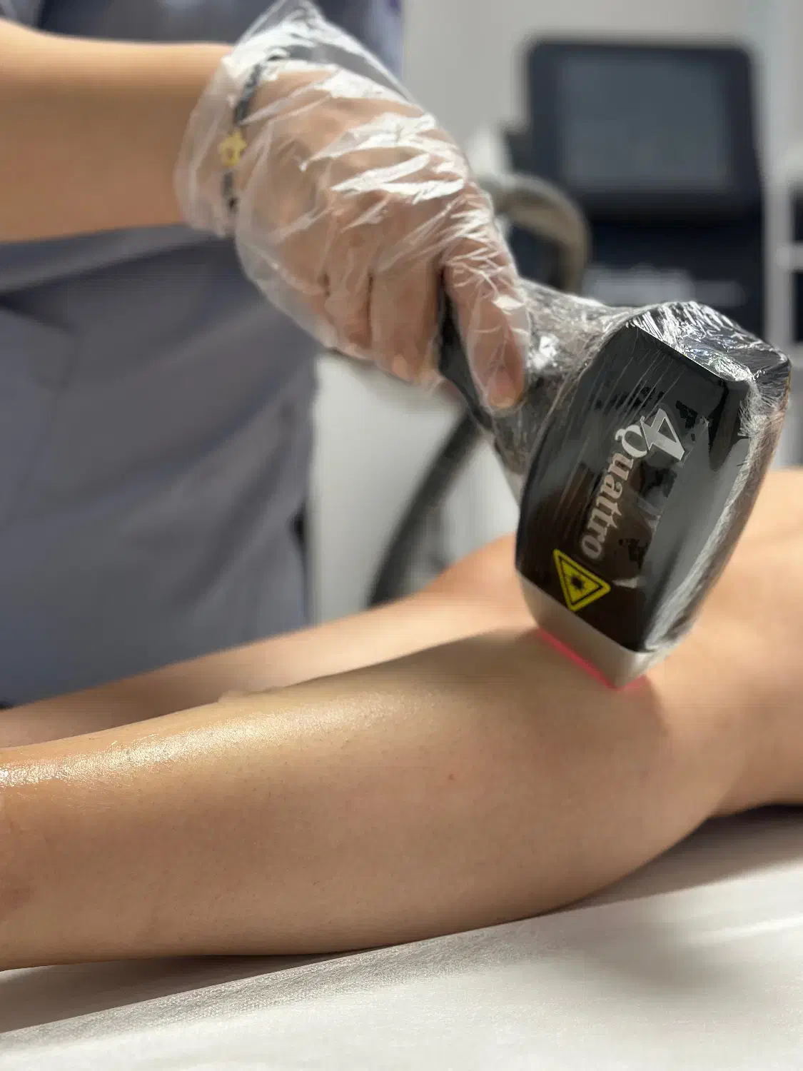 لیزر موهای زائد۲۰۲۵|پزشکی|گرگان, |دیوار