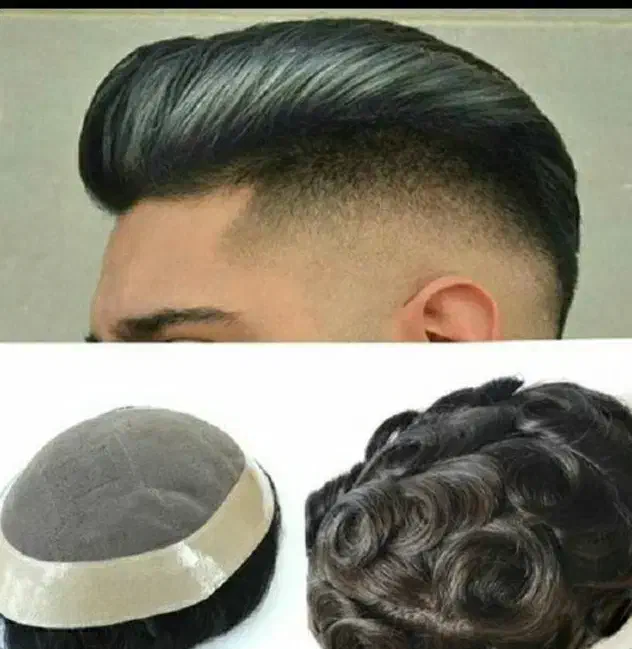 پروتز مو|آرایشی، بهداشتی، درمانی|اهواز, اهواز|دیوار