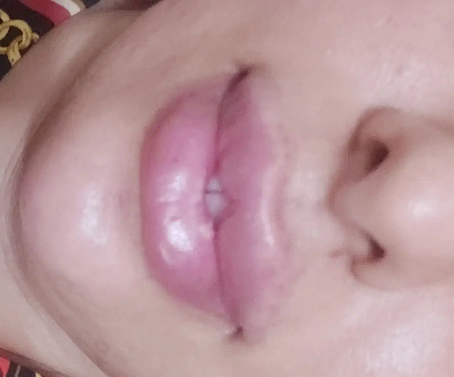 آموزش ژل و بوتاکس|خدمات آموزشی|بندر ماهشهر, |دیوار