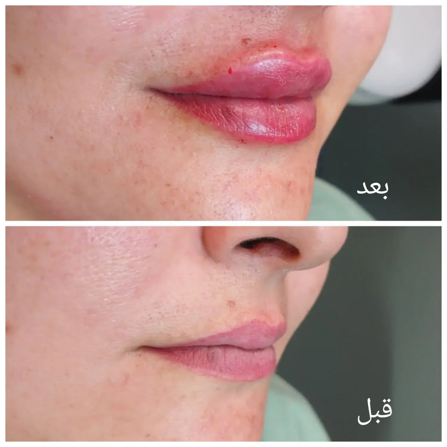 لیزر|خدمات آرایشگری و زیبایی|گلبهار, شهر جدید گلبهار|دیوار