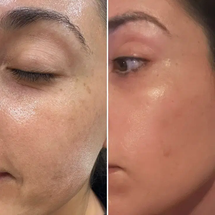 پک روشن کننده صورت ،دست،بودن|آرایشی، بهداشتی، درمانی|کرج, گلشهر|دیوار