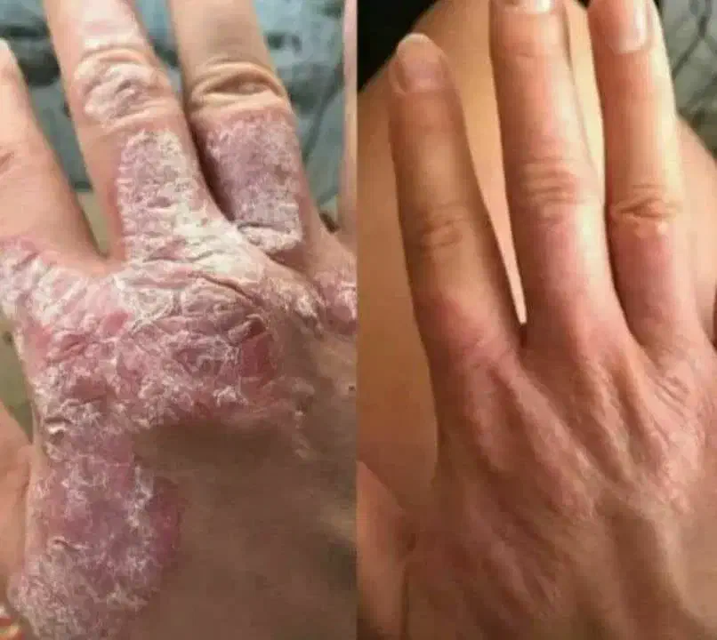 طب سنتی|آرایشی، بهداشتی، درمانی|زابل, |دیوار