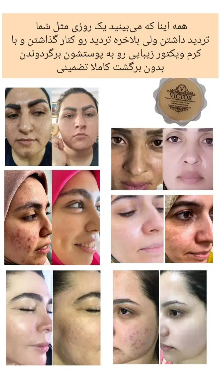 کرم فوقالعاده قوی ویکتور قیمت یک میلیون .|حراج|بروجرد, |دیوار