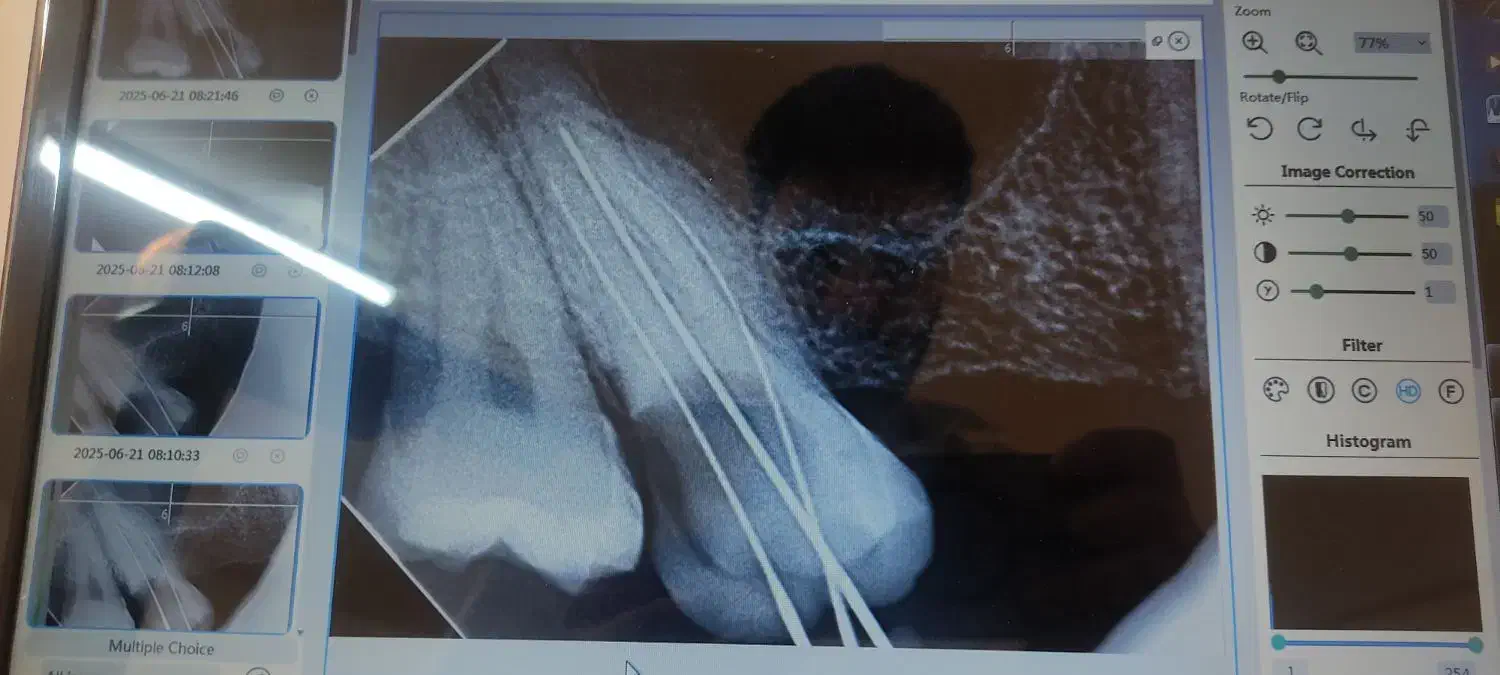 فروش رادیوگرافی سه بازو اصل فونا ایتالیا|پزشکی|بوکان, |دیوار