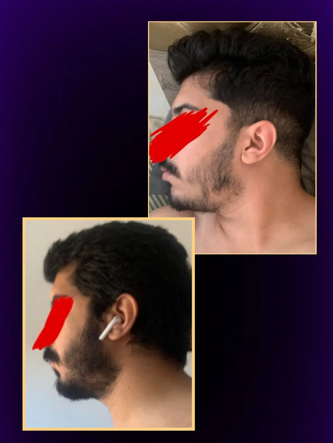 ریش ، سبیل|آرایشی، بهداشتی، درمانی|رشت, شهرک احمد خمینی|دیوار
