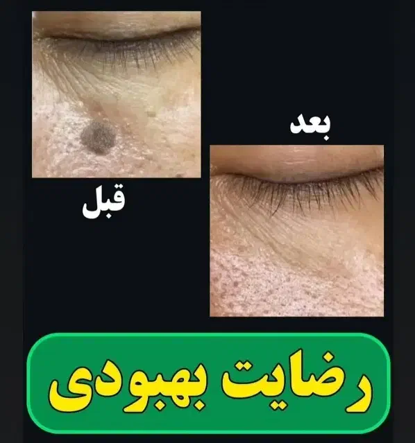 درمان|آرایشی، بهداشتی، درمانی|فیروزآباد (لرستان), |دیوار