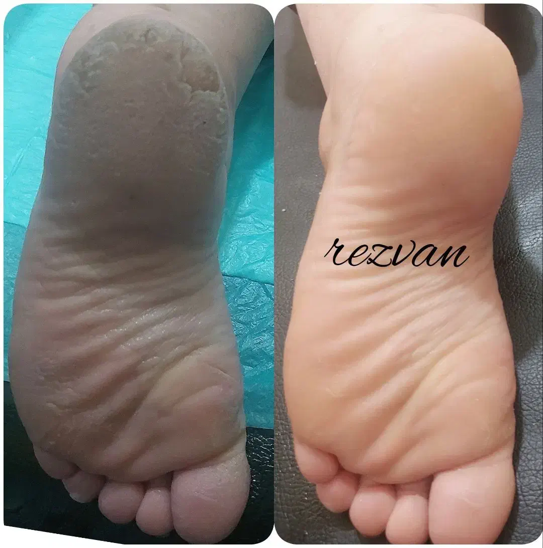 پدیکور وناخن|خدمات آرایشگری و زیبایی|مسجد سلیمان, |دیوار