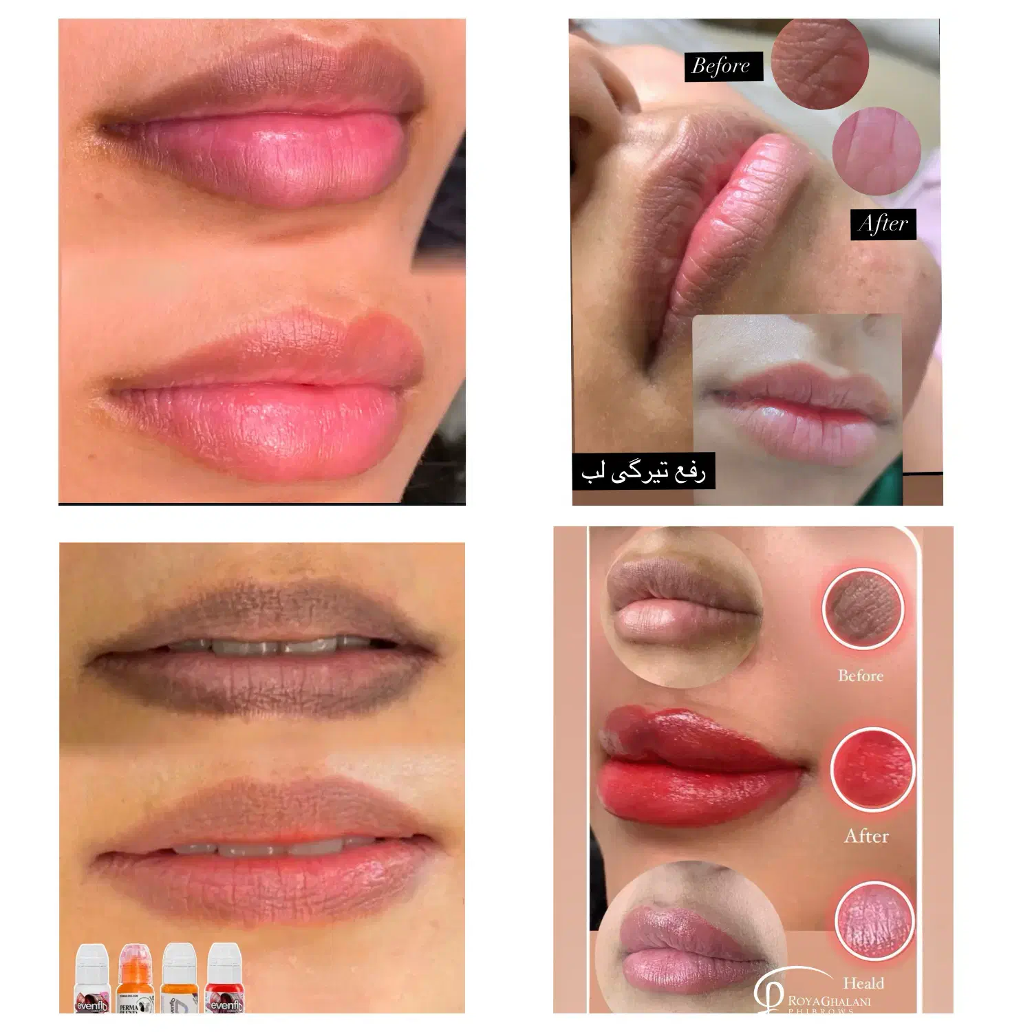 میکروبلیدینگ و میکروپیگمنتیشن و ریموو|خدمات آرایشگری و زیبایی|کیش, |دیوار