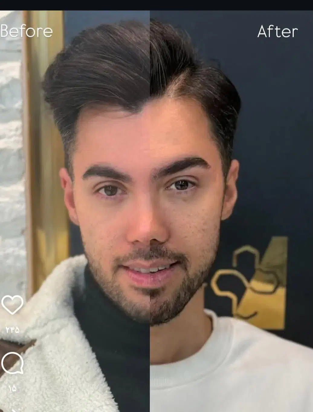 خدمات تخصصی تزریق بوتاکس فیلر بانوان و آقایون|خدمات آرایشگری و زیبایی|بیرجند, |دیوار