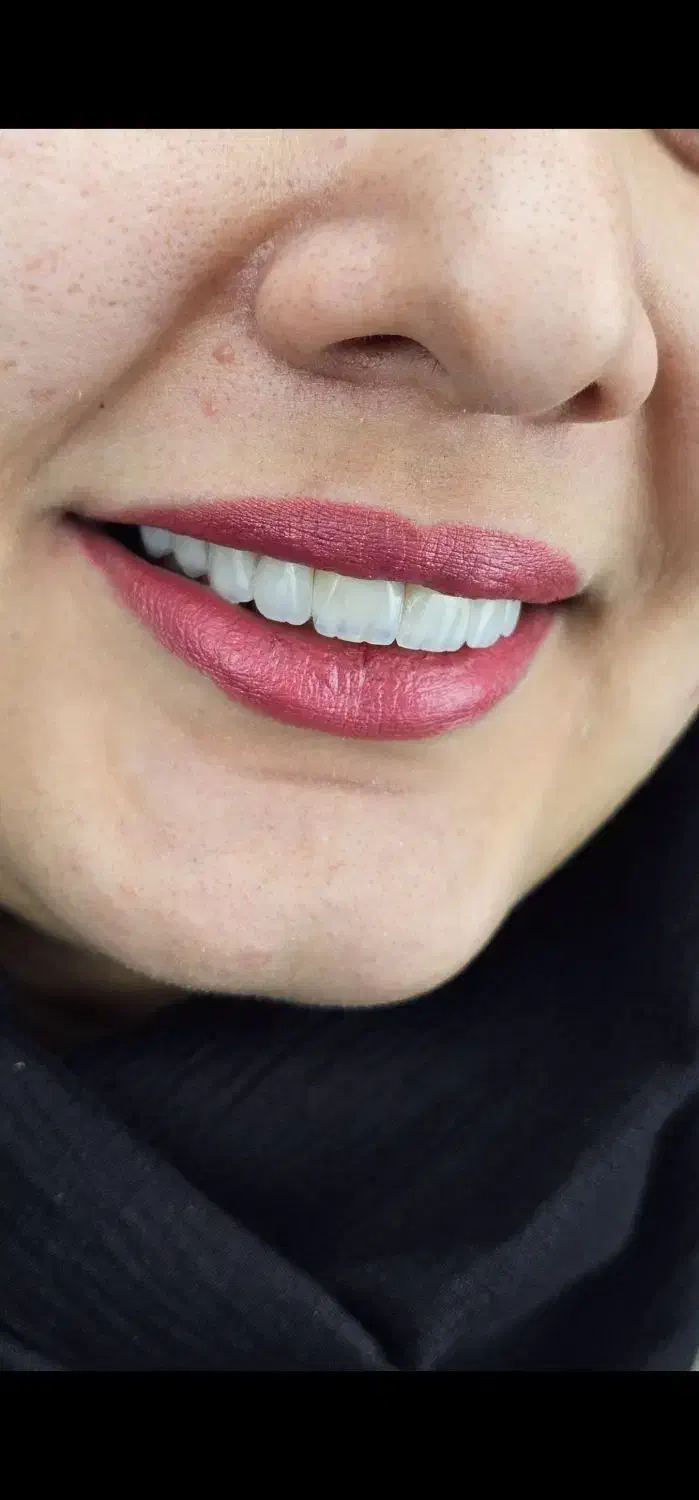 مطب دندانپزشکی طرف قرارداد با بیمه های تکمیلی|خدمات آرایشگری و زیبایی|قزوین, |دیوار