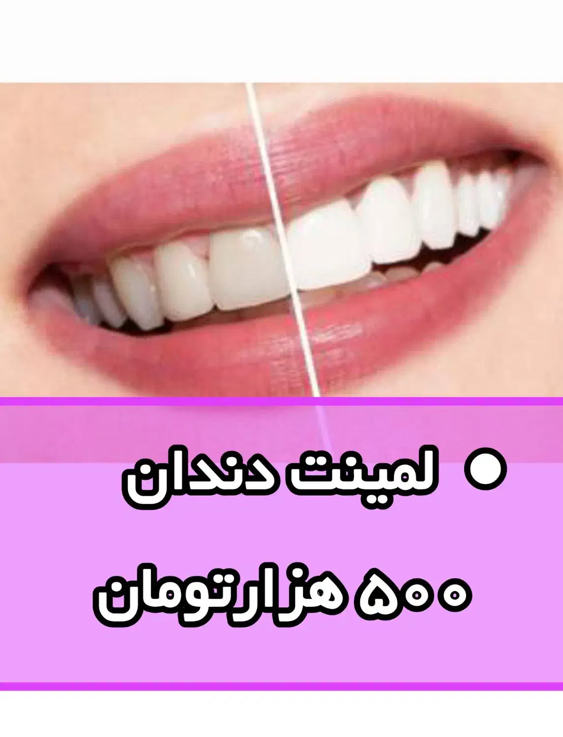 لاینو مکسFP|تخت و صندلی بچه|سنندج, |دیوار