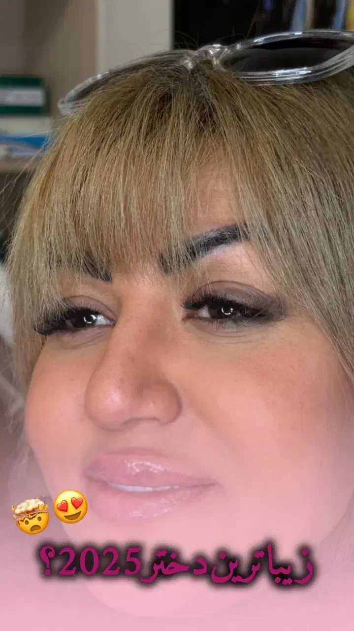 آموزش تخصصی و درمانی ژل و بوتاکس|خدمات آموزشی|اصفهان, مهدی آباد|دیوار