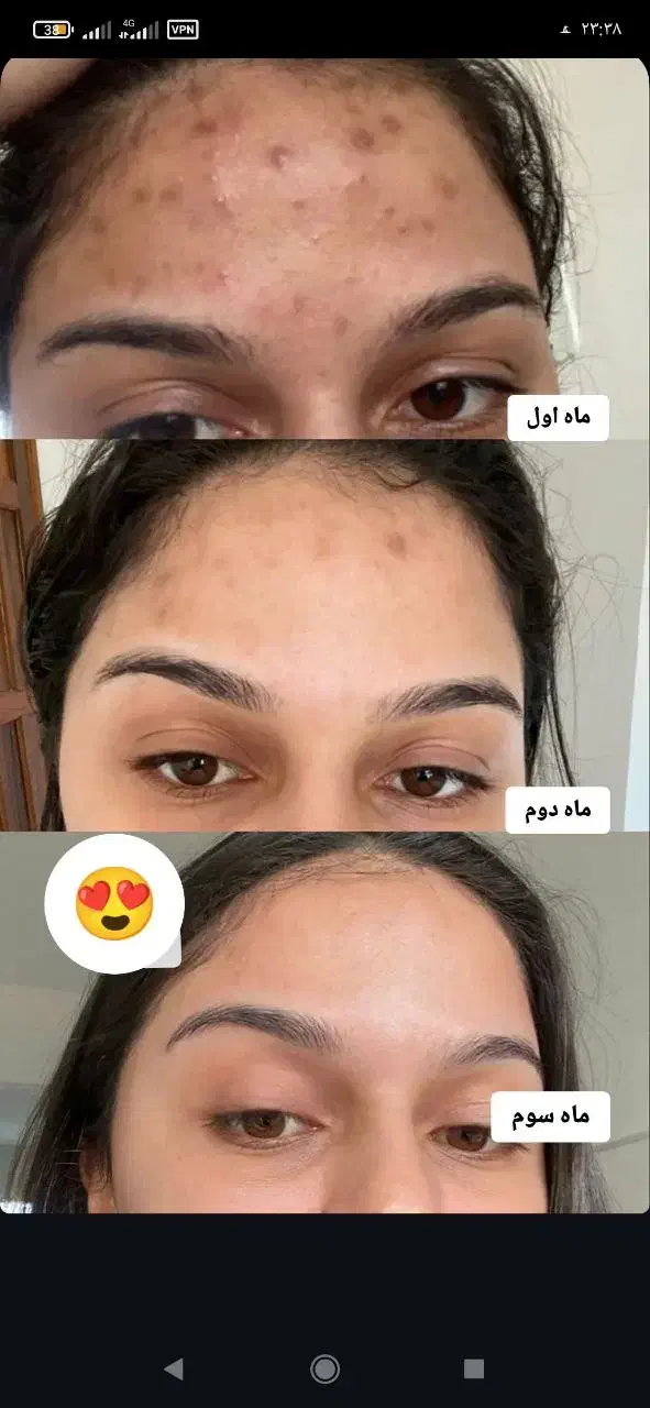 ماسک وصابون کربن ضدجوش|آرایشی، بهداشتی، درمانی|ایرانشهر, |دیوار