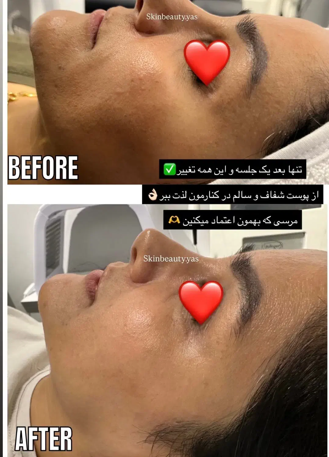 مدل پاکسازی صورت و بدن(خانم و اقا)باهم یا جدا|خدمات آرایشگری و زیبایی|مشهد, کوثر|دیوار