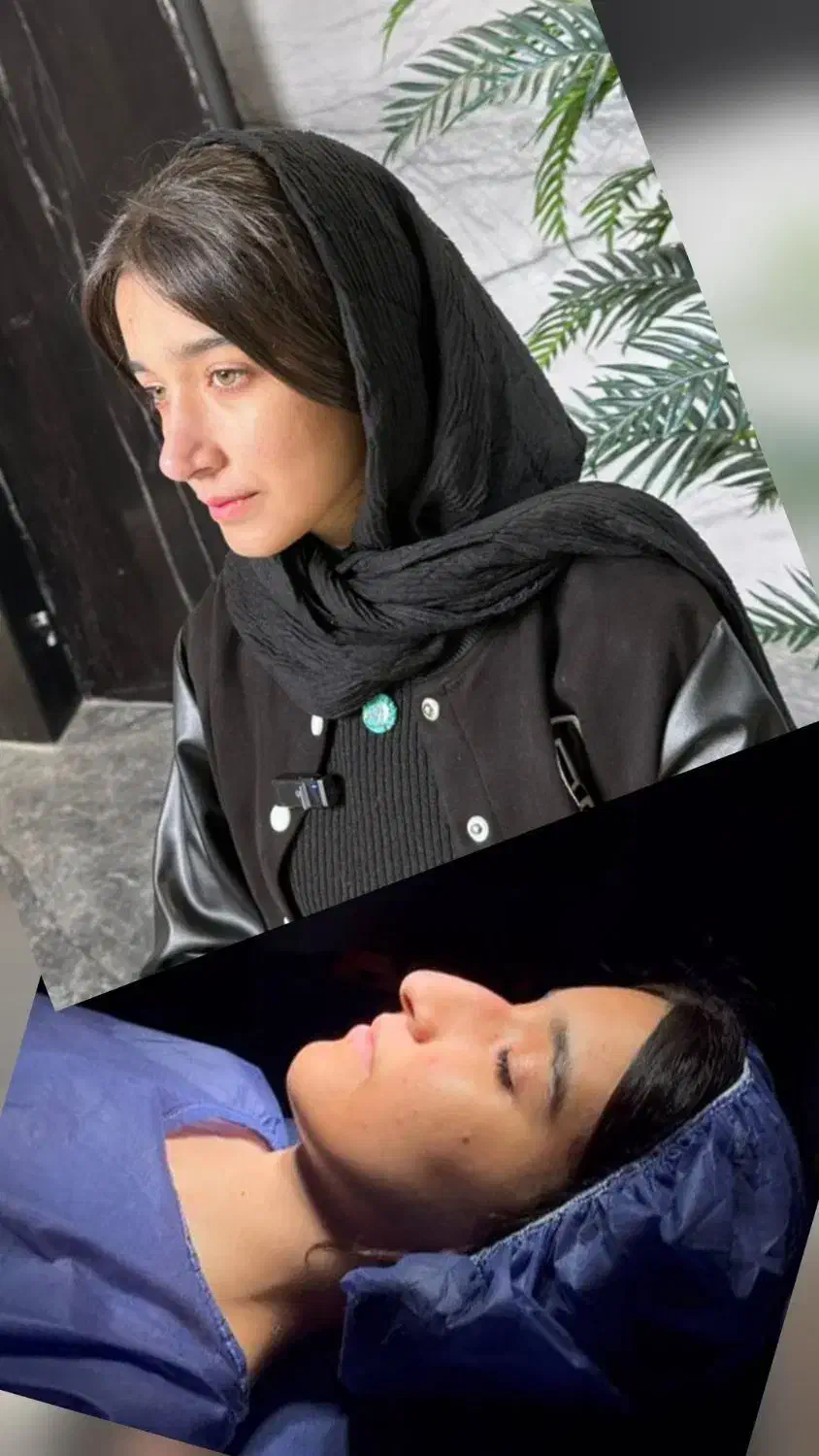 عمل بینی لیفت صورت اقساط تا۲۴ ماه|خدمات آرایشگری و زیبایی|تهران, تجریش|دیوار