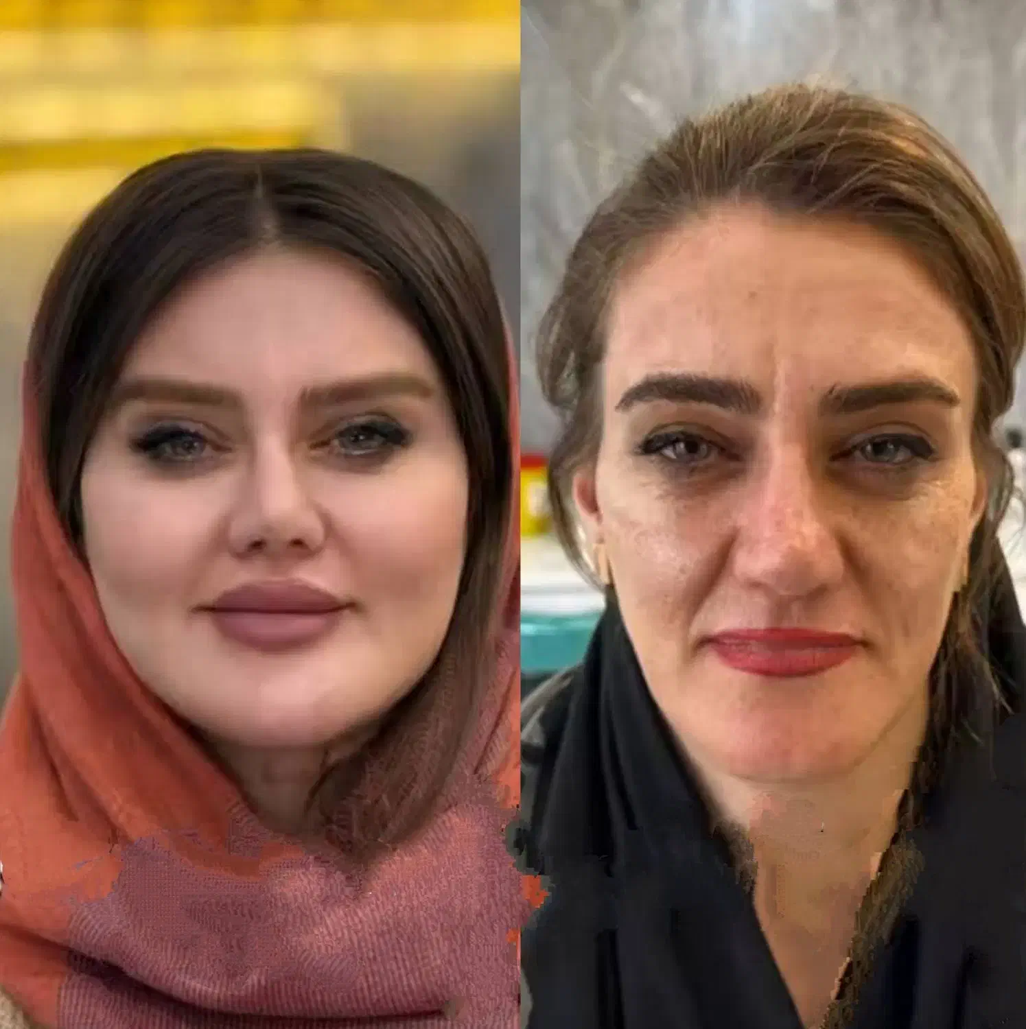 تزریق تخصصی ژل وبوتاکس،چربی،هایفو،نخ،توسط پزشک|خدمات آرایشگری و زیبایی|کرمانشاه, |دیوار