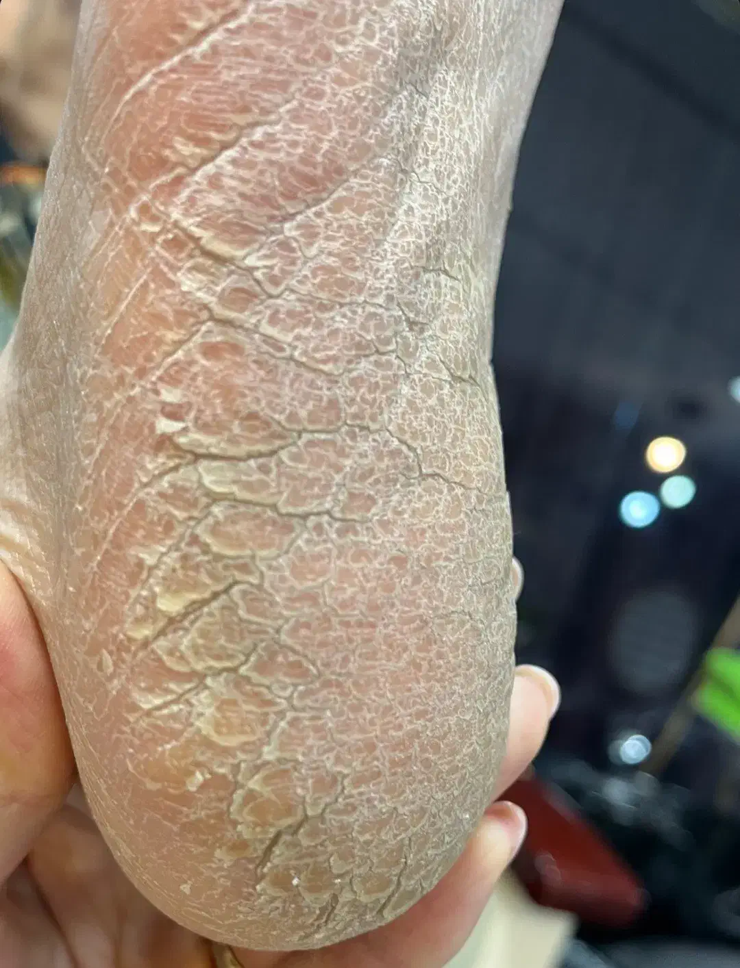 آموزش و خدمات پدیکور تخصصی به سبک روسی|خدمات آرایشگری و زیبایی|خوی, |دیوار