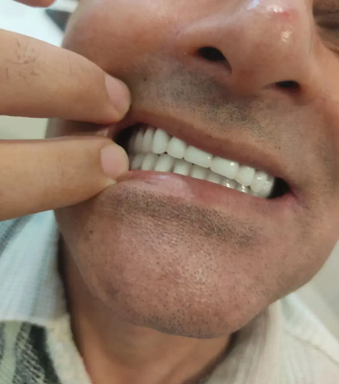 دندان مصنوعی  ( تمام چک )|آرایشی، بهداشتی، درمانی|پارس‌آباد, |دیوار