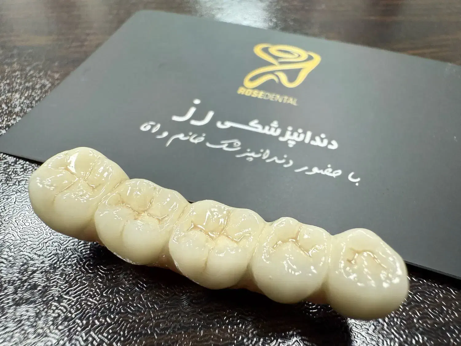 روکش ایمپلنت دندان مصنوعی|خدمات آرایشگری و زیبایی|ری, شهرری|دیوار